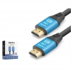 NODAR ND4052 HDMI 2.0 Kablo 4K 60 Hz OD 8.0 mm 5 m Siyah Mavi