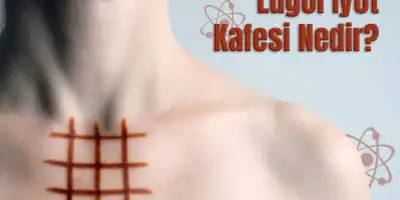 Lugol İyot Kafesi nedir?