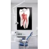 Diş Anatomisi ve Kök Kanalı Görselli Cam Tablo