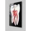 Diş Anatomisi ve Kök Kanalı Görselli Cam Tablo