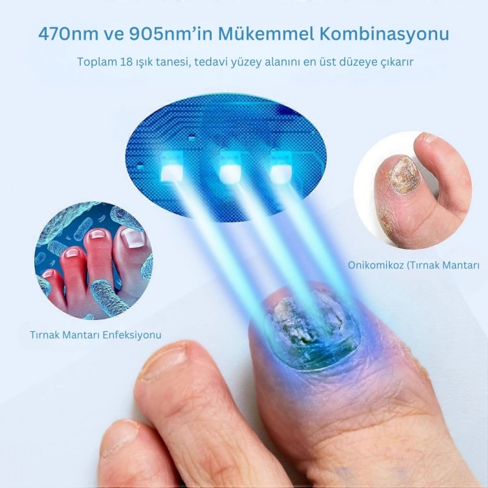 ShoptTech 36W Katlanabilir Tırnak Mantarı Işık Cihazı El ve Ayak Tırnağı İçin LED Fototerapi Lambası, USB Şarjlı