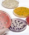 Hazır SS ( Salmonella Shigella ) Besiyeri - 10 Adetlik Set - Yüksek Kaliteli