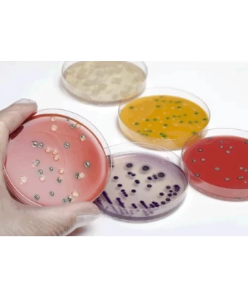 Hazır SS ( Salmonella Shigella ) Besiyeri - 10 Adetlik Set - Yüksek Kaliteli