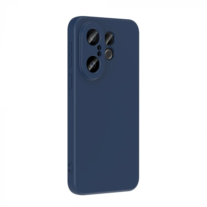 Vivo X200 FE 5G Kılıf Zore Mara Lansman Kapak