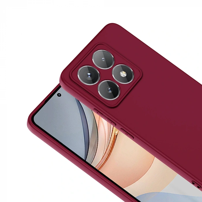 Xiaomi 14T Kılıf Zore Mara Lansman Kapak