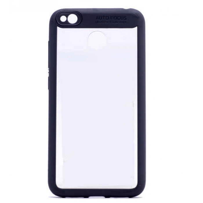 Xiaomi Redmi 4X Kılıf Zore Buttom Kapak