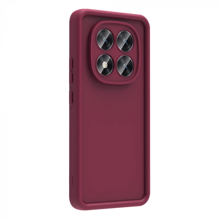 Xiaomi Redmi Note 14 Pro Plus Kılıf Kamera Korumalı Zore Ananas Kapak