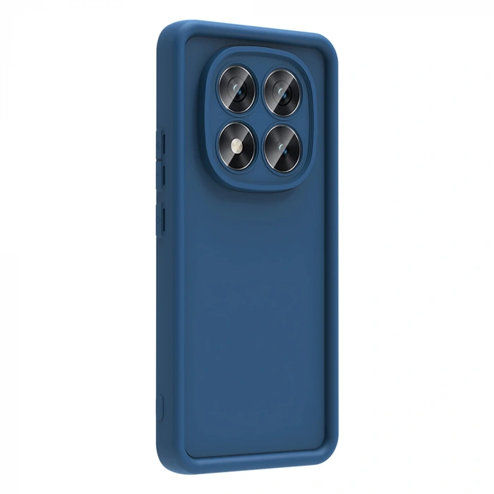 Xiaomi Redmi Note 14 Pro Plus Kılıf Kamera Korumalı Zore Ananas Kapak