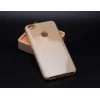 Xiaomi Redmi Note 5A Kılıf Zore Shining Silikon