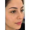 Altın Renk 20li Taşlı Halka Hızma Set