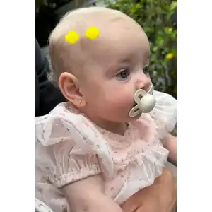 2li Sarı Renk Ponponlu Saçsız Bebek Tokası