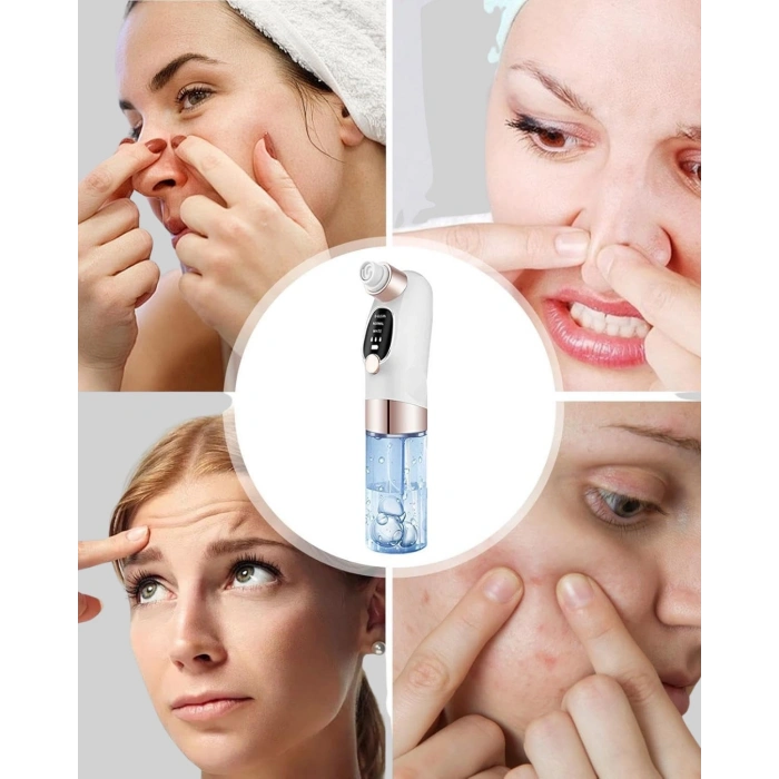 Ayarlanabilir Emiş Gücü İle Profesyonel Siyah Nokta Temizleyici