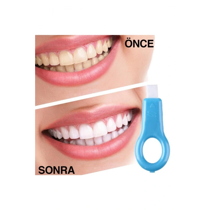 Etkili Ağız Bakımı Jel Diş Beyazlatıcı Leke Giderici