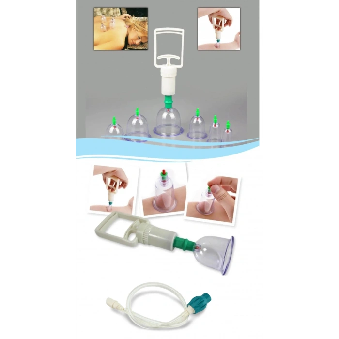 Hacamat Seti Hortumlu  Vakumlu Hortumlu Kupa Çekme Seti (Model 1) (599)