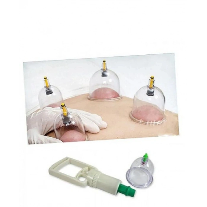 Hacamat Seti  Vakumlu Kupa Çekme Seti (Model 2) (599)