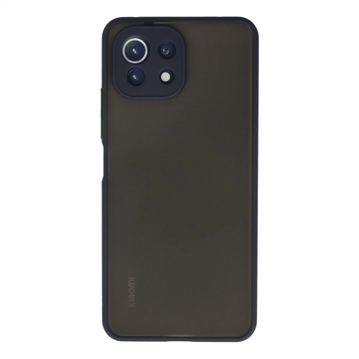 Xiaomi Mi 11 Lite Kılıf Montreal Silikon Kapak - Lacivert