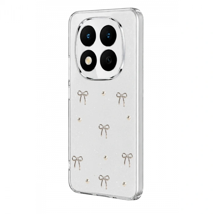 Xiaomi Redmi Note 15 4g Fiyonk Desenli Kapak - Desen 5