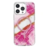 Onegif Apple İphone 14 Pro Max Lotus Simli Magsafe Kapak - Pembe