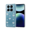 Xiaomi Redmi Note 14 Pro 4g Fiyonk Desenli Kapak - Desen 10