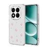 Xiaomi Redmi Note 15 4g Fiyonk Desenli Kapak - Desen 3