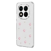 Xiaomi Redmi Note 15 Pro 4g Fiyonk Desenli Kapak - Desen 3
