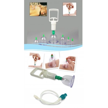 Hacamat Seti Hortumlu  Vakumlu Hortumlu Kupa Çekme Seti (Model 2) (599)