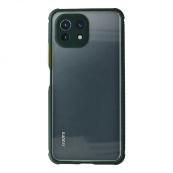 Xiaomi Mi 11 Lite Kılıf Miami Şeffaf Silikon - Koyu Yeşil