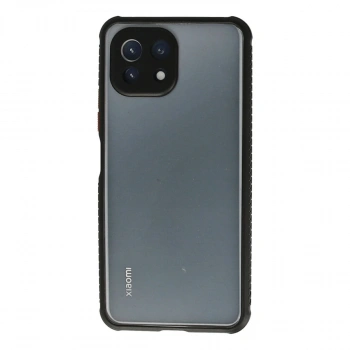 Xiaomi Mi 11 Lite Kılıf Miami Şeffaf Silikon - Siyah