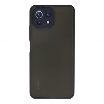 Xiaomi Mi 11 Lite Kılıf Montreal Silikon Kapak - Lacivert