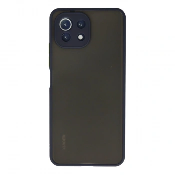 Xiaomi Mi 11 Lite Kılıf Montreal Silikon Kapak - Lacivert