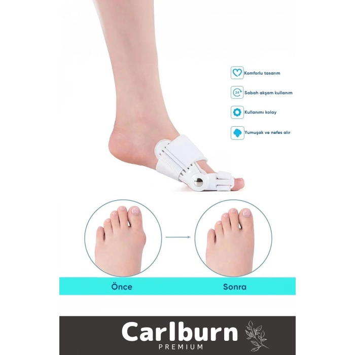 Özel Üretim Yumuşak Yıkanabilir Bedensiz Sağ Sol Ayak Uyumlu Baş Parmak Kemik Düzeltici 2 Adet