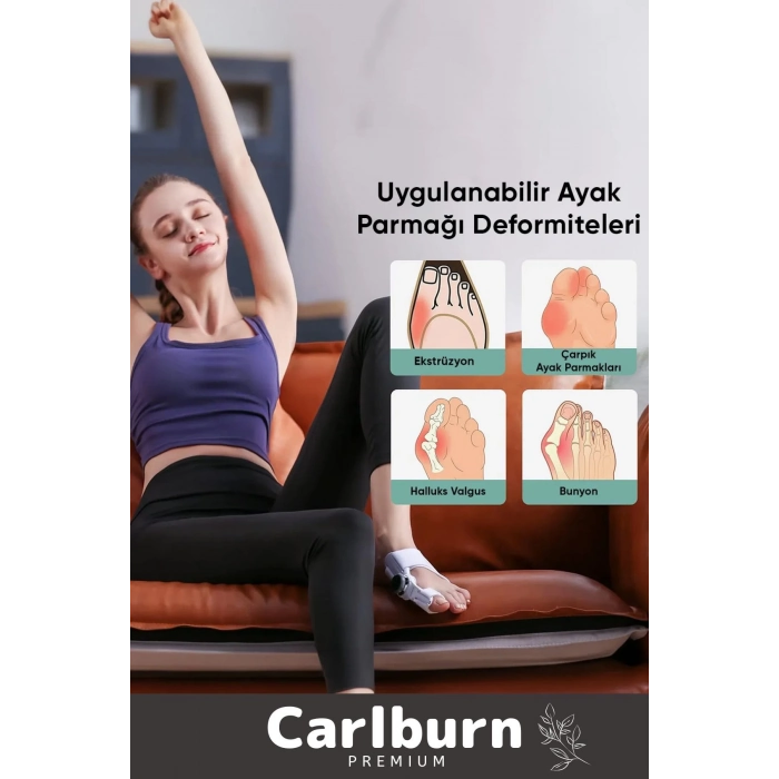 Özel Üretim Yumuşak Yıkanabilir Bedensiz Sağ Sol Ayak Uyumlu Baş Parmak Kemik Düzeltici 2 Adet