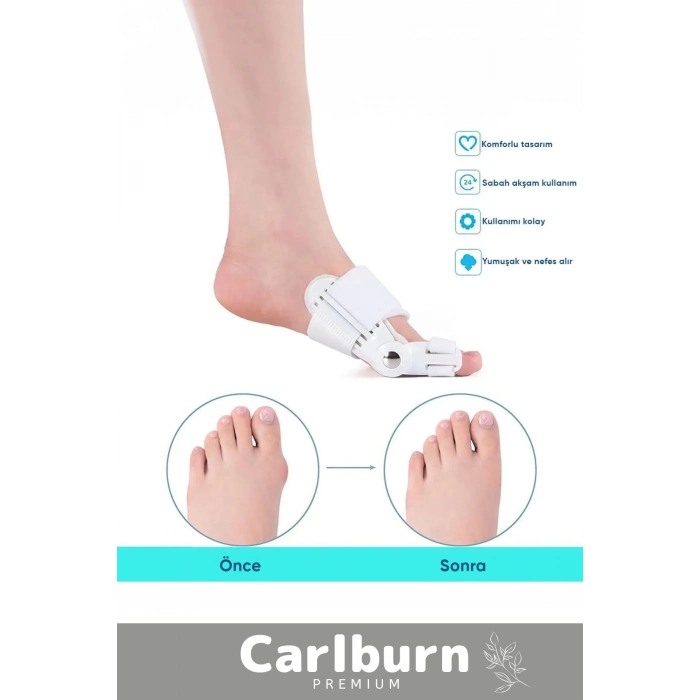 Özel Üretim Yumuşak Yıkanabilir Bedensiz Sağ Sol Ayak Uyumlu Baş Parmak Kemik Düzeltici 1 Adet