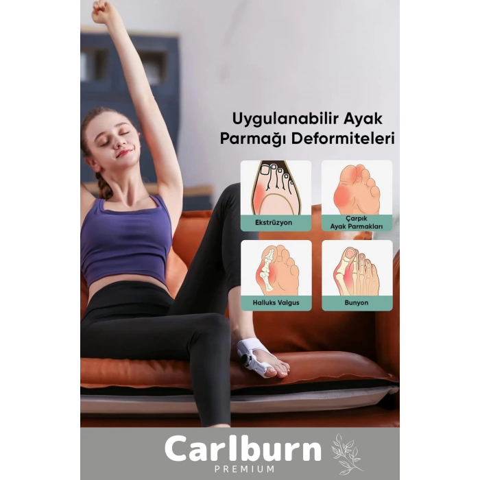 Özel Üretim Yumuşak Yıkanabilir Bedensiz Sağ Sol Ayak Uyumlu Baş Parmak Kemik Düzeltici 1 Adet