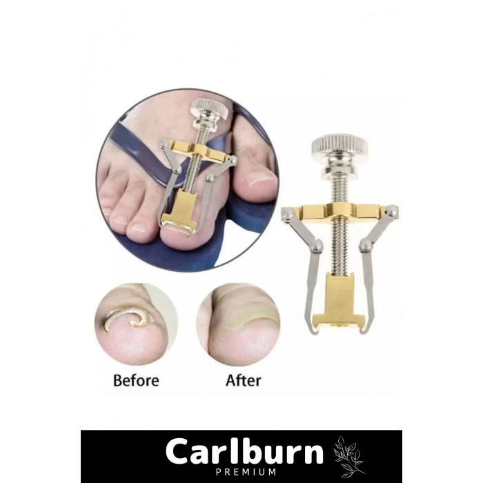 Özel Üretim Paslanmaz Çelik Ayak Parmak Batık Tırnak Batması Düzeltme Çıkartıcı Pens Aparat