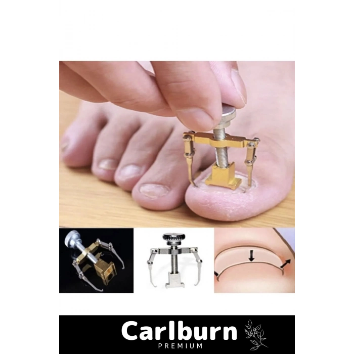 Özel Üretim Paslanmaz Çelik Ayak Parmak Batık Tırnak Batması Düzeltme Çıkartıcı Pens Aparat