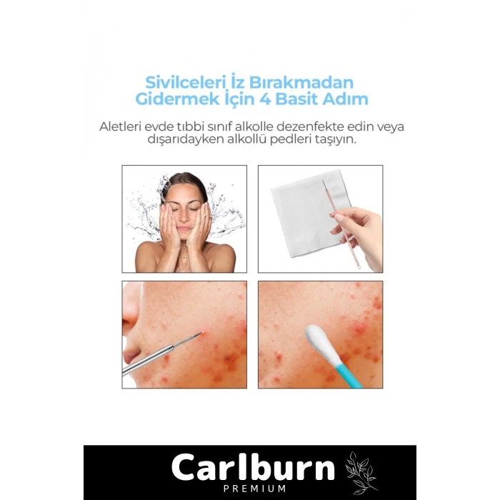 Özel Üretim Paslanmaz Çelik Günlük Cilt Bakım Siyah Nokta Akne Temizleyici Kutulu Komedon 4lü Set