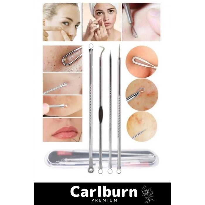 Özel Üretim Paslanmaz Çelik Günlük Cilt Bakım Siyah Nokta Akne Temizleyici Kutulu Komedon 4lü Set