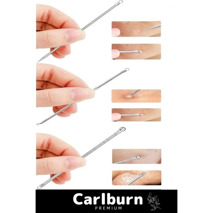 Özel Üretim Paslanmaz Çelik Günlük Cilt Bakım Siyah Nokta Akne Temizleyici Kutulu Komedon 4lü Set