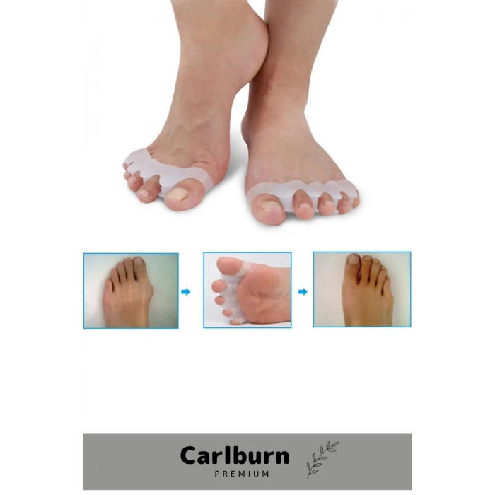 Premium A Kalite Kemik Büyümesi Karşıtı Şekil Bozukluğu Ayak 5 Parmak Ayıran Silikon Bunyon Ayırıcı