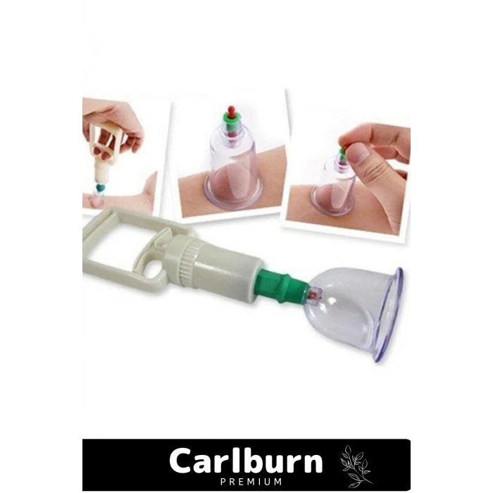 Özel Üretim Selülit Çatlak Giderici Vakumlu Masaj Aleti 24lü Kupa Hacamat Seti