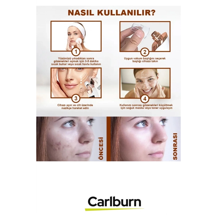 Profesyonel Dijital Göstergeli Şarjlı 6 Başlıklı 3 Kademeli Vakumlu Siyah Nokta Yüz Temizleme Cihazı