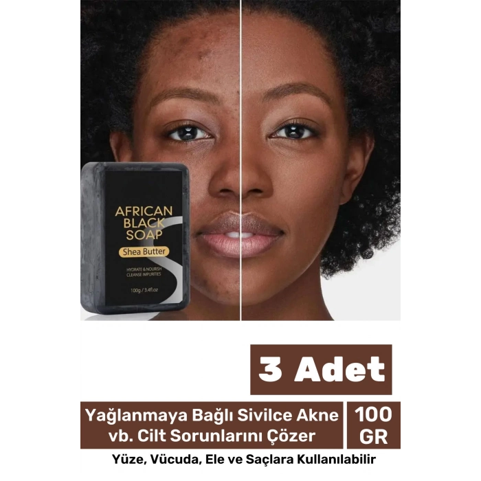 100% Doğal Güzel Kokulu El Yüz Saç Vücut Cilt Onaran Kolajen Etkili Afrika Bitkisel Sabun 3 Adet