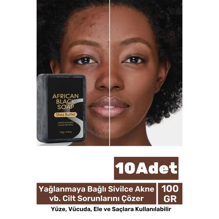 100% Doğal Güzel Kokulu El Yüz Saç Vücut Cilt Onaran Kolajen Etkili Afrika Bitkisel Sabun 10 Adet