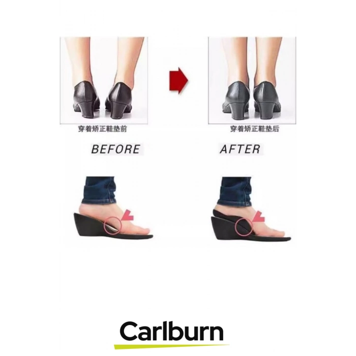 Özel Üretim Yumuşak Silikon Yürüyüş Konfor Artırıcı Esnek Düz Taban Düzeltici Topuk Yastığı