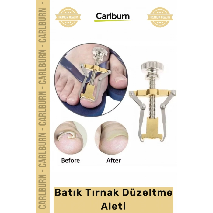 Özel Üretim Ayak Tırnağı Batma Ağrısı Giderici Evde Güvenli Kolay Bakım Batık Tırnak Düzeltici