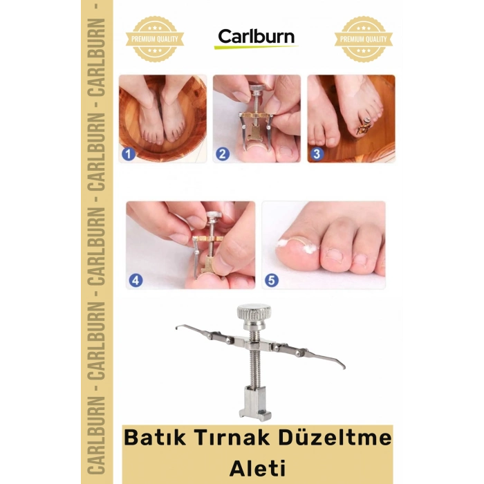 Özel Üretim Ayak Tırnağı Batma Ağrısı Giderici Evde Güvenli Kolay Bakım Batık Tırnak Düzeltici