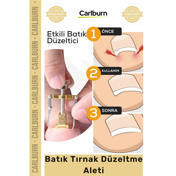 Özel Üretim Ayak Tırnağı Batma Ağrısı Giderici Evde Güvenli Kolay Bakım Batık Tırnak Düzeltici