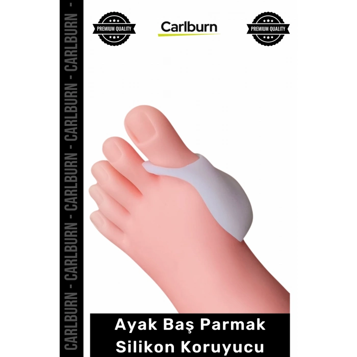 Özel Üretim Yıkanabilir Halluks Valgus Bunyon Kemik Aparat Ayak Baş Parmak Silikon Koruyucu