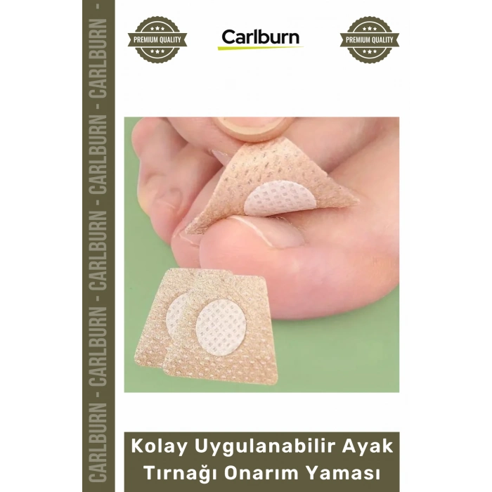 Özel Üretim Mantar Karşıtı Yenileyici Bakım Etkili Kolay Uygulanabilir Ayak Tırnağı Onarım Yaması